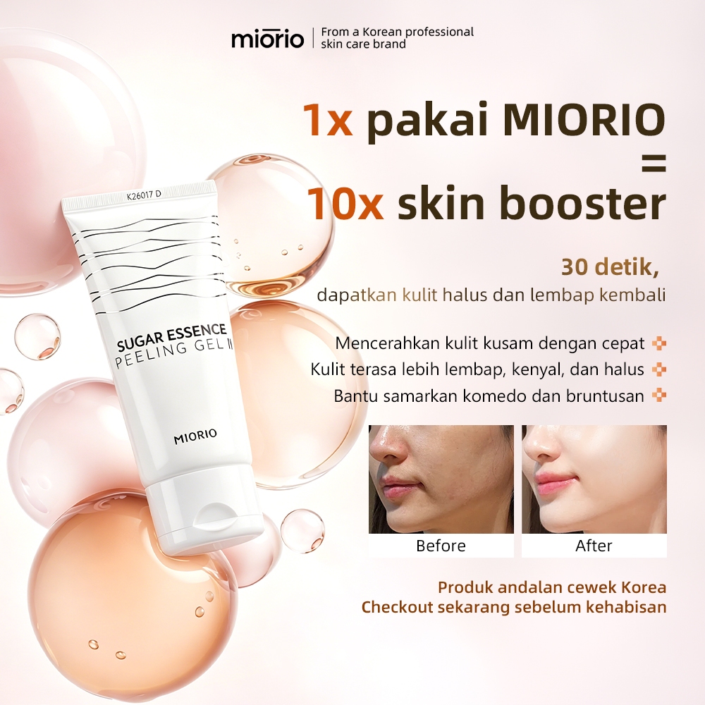[Miorio] Peeling Gel 150ml - Exfoliating Gel Korea - Angkat Sel Kulit Mati & Komedo - Deep Cleansing