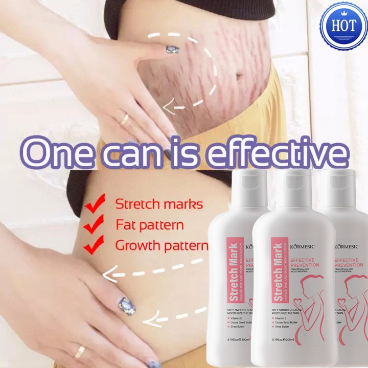 Stretch Mark Oil 200ml Menyusui Menghilangkan stretch mark saat hamil Perawatan tubuh Stretch mark s