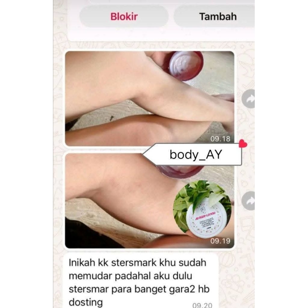 HB AY kulit susah putih 100mil