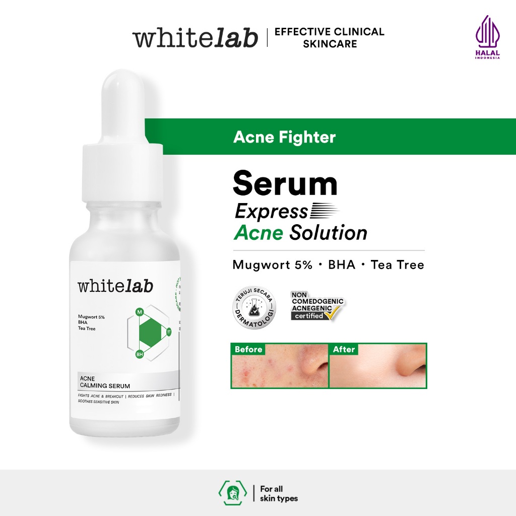 Whitelab Acne Calming Serum - Serum untuk Kulit Jerawat, Bruntusan, dan Berminyak dengan Mugwort, BH