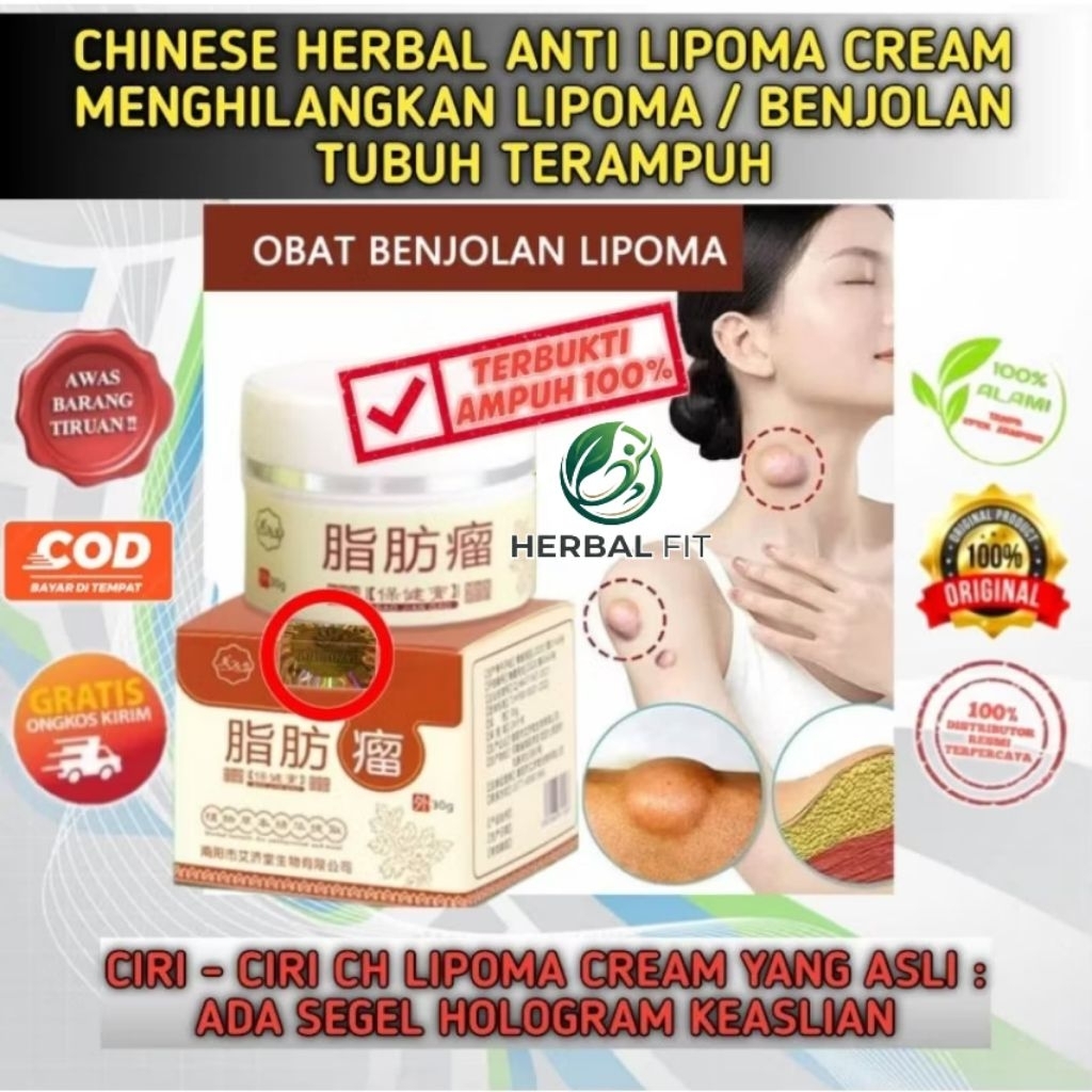 CHINESE HERBAL LIPOMA CREAM ASLI MENGHILANGKAN LIPOMA , UCI UCI , BENJOLAN TUBUH TERBAIK TUMOR LIPOM