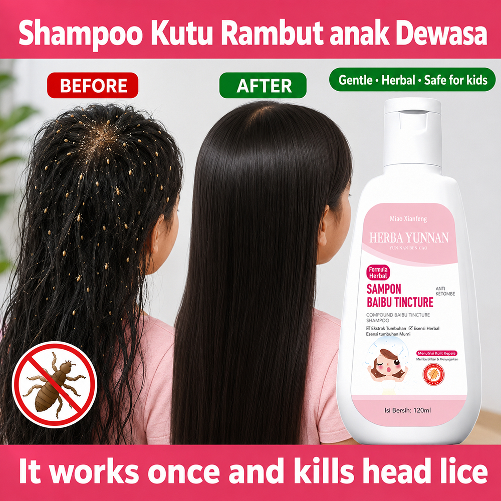 Shampo Kutu Rambut Anak dan Dewasa shampo anti kutu herbal shampo kutu rambut kutu kepala rambut ala