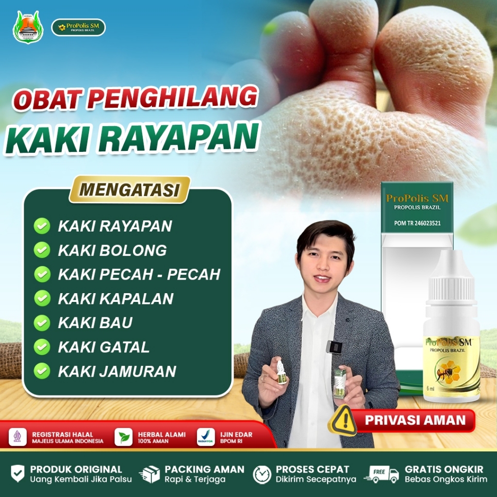 Obat Kaki Rayapan Bau Kaki Kapalan Jamur Kaki, Kaki Bolong Bolong, Kaki Krodok - Propolis SM Asli