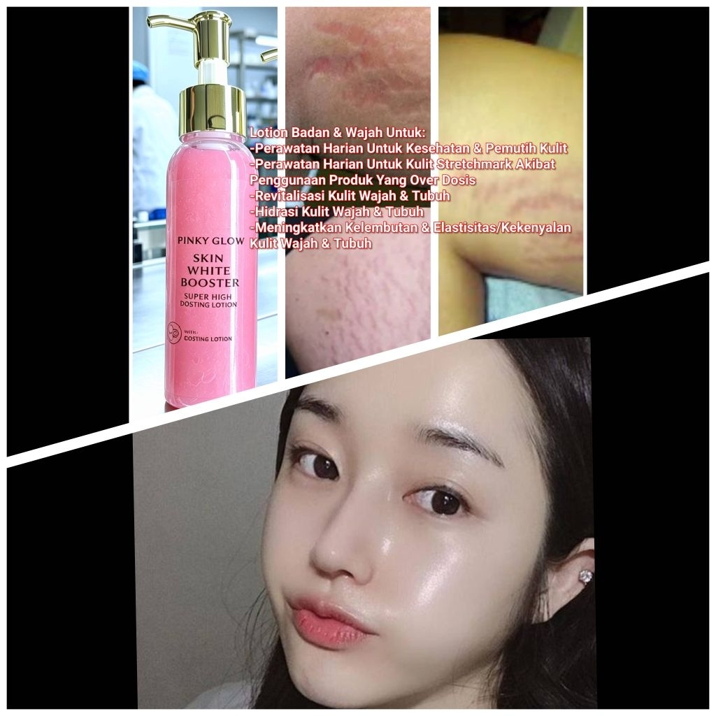 HB DOSTING PINKY GLOW UNTUK TUBUH & WAJAH || BISA UNTUK PERAWATAN STRETCHMARK AKIBAT OVERDOSTING|| P