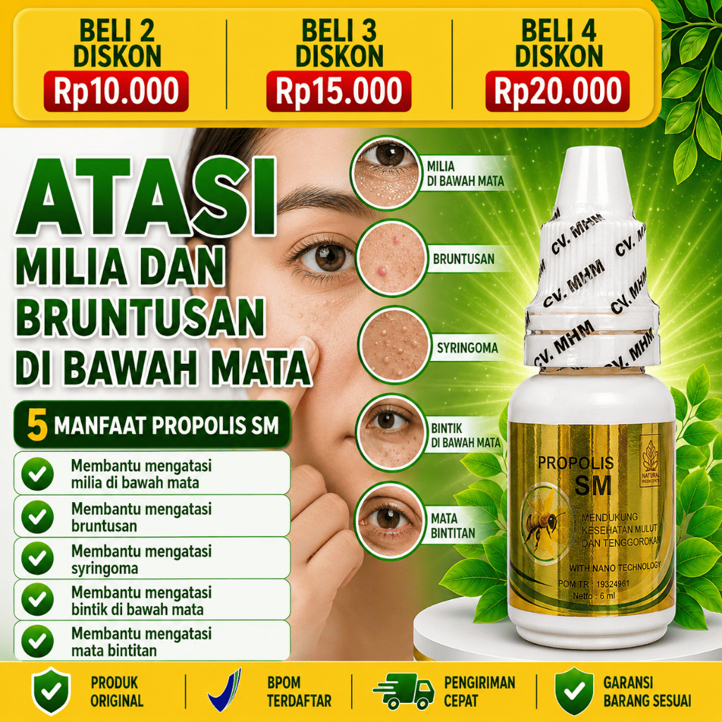 PROPOLIS SM Obat Milia Di Wajah Menghilangkan Bintik Di Bawah Mata Syringoma Bruntusan