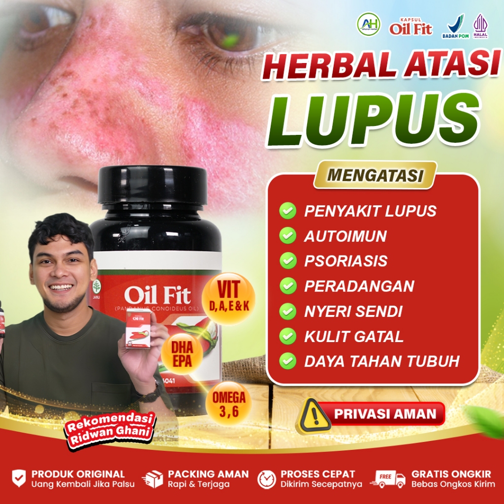Obat Lupus Autoimun Psoriasis Kulit Ruam Bersisik Eksim Dermatitis - Oil Fit 50 Kapsul Original BPOM