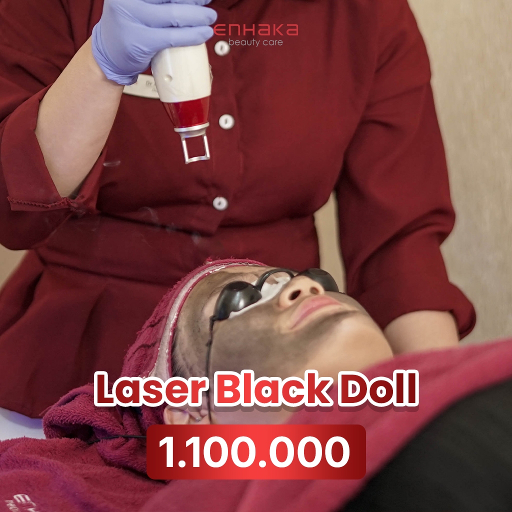 Laser Black Doll Enhaka Bandung