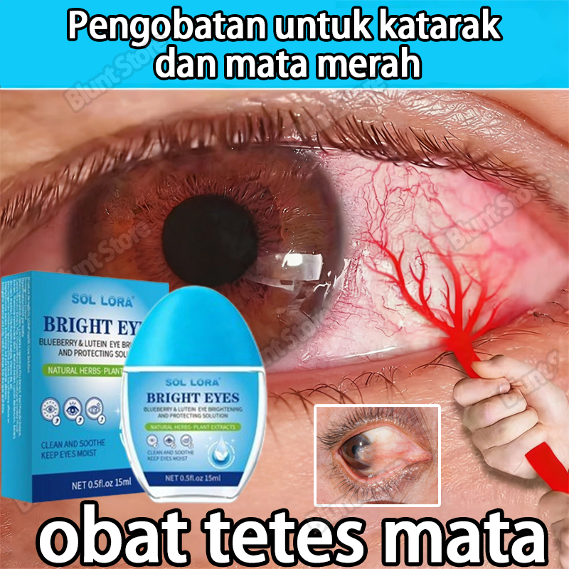 Obat Tetes Mata Katarak Tanpa Operasi  Mata Minus Paling Ampuh Tetes Mata Katarak Obat Mata Merah Ey