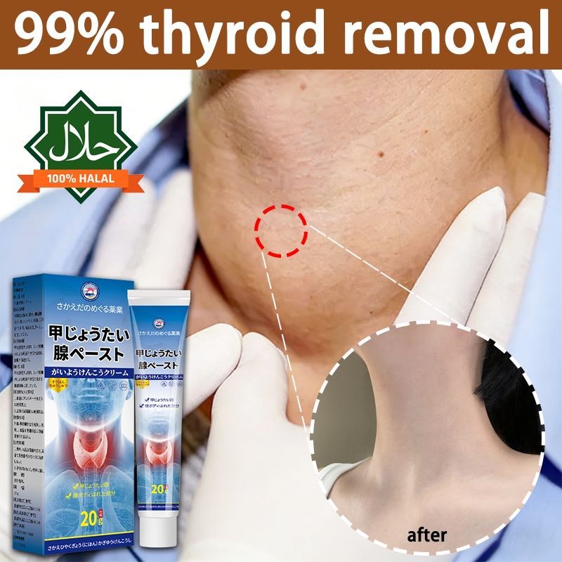 [100% Asli]salep tiroid/krim tiroid/obat tiroid Mengobati kista tiroid; mengandung bahan herbal alam