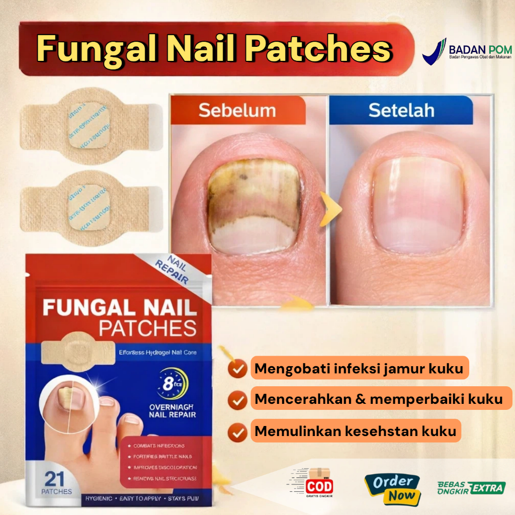 Obat Jamur Kuku 21PCS Fungal Nail Patch Obat Cantengan Kuku Rusak Busuk Berjamur Anti Infeksi Pember