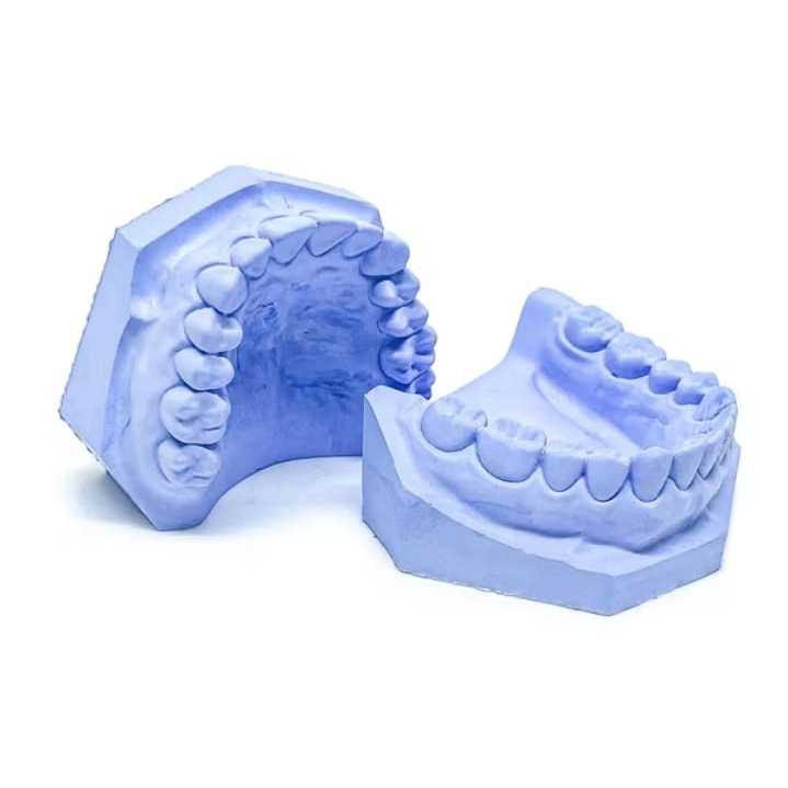 Model Gigi Gips Biru