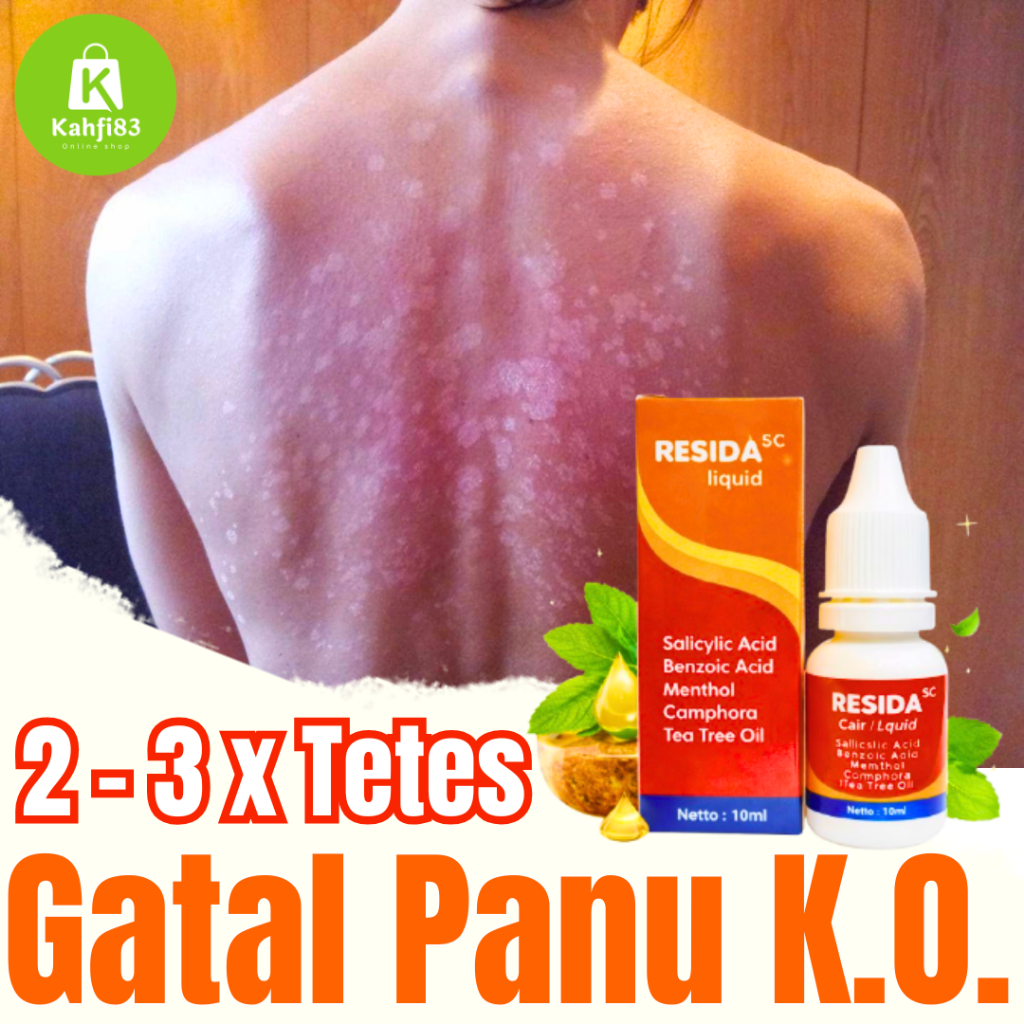 Resida Cair Obat Panu Kurap Kadas Hapur Salep Kutu Air Gatal Jamur Kulit Selangkangan Paling Ampuh