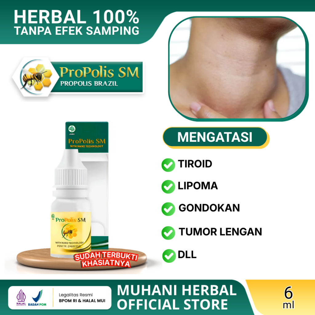 Propolis SM Ekstrak Brazillian Propolis | Obat Pengempis Benjolan Tiroid, Lipoma, Keloid, Gondokan, 