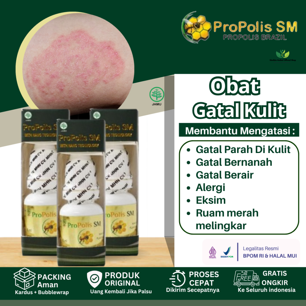 Propolis SM Obat Gatal Kurap Kulit Jamuran Kulit Kering Gatal Eksim Panu Gatal Seluruh Badan Anak & 