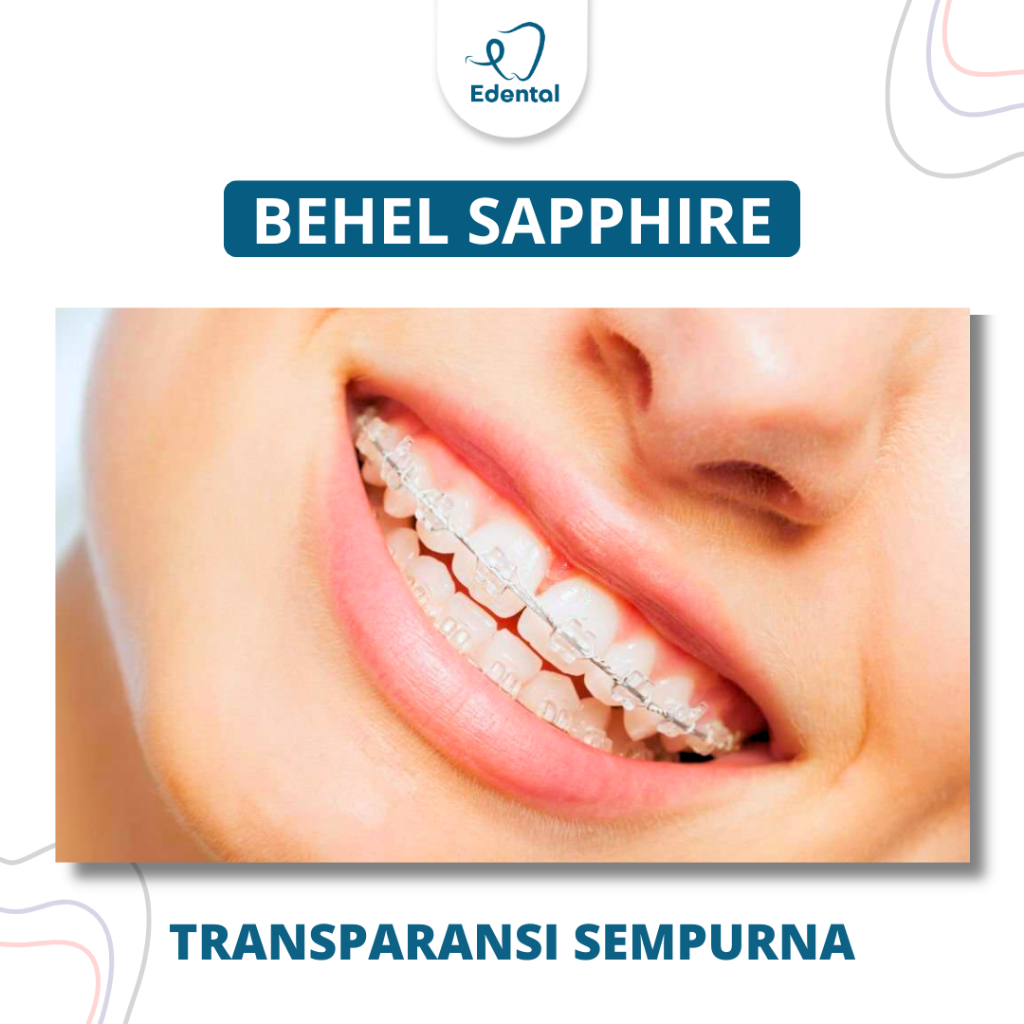 Pasang Behel Sapphire Kristal Estetik - Perawatan Kawat Gigi Permanen Transparan Sapphire Transparan