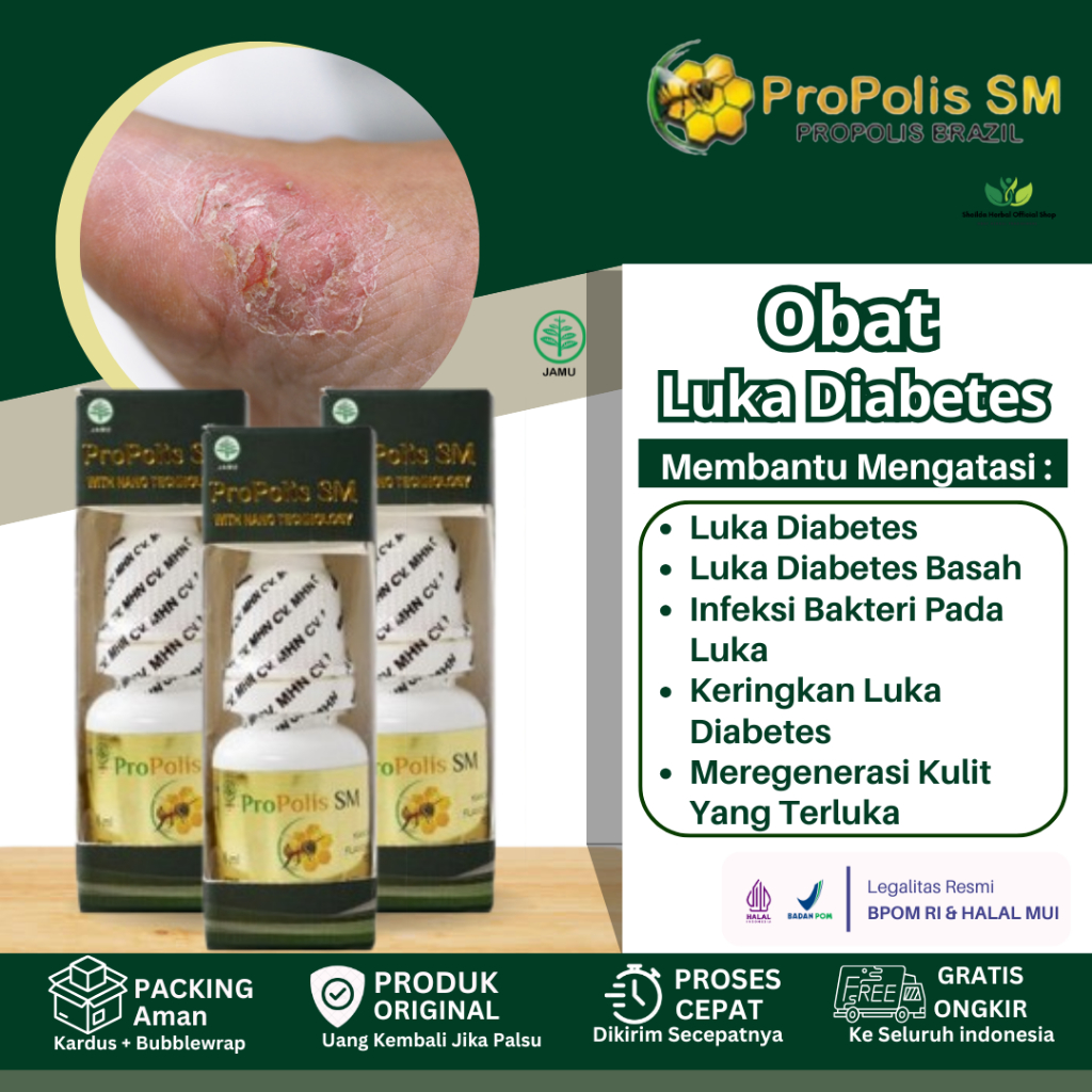 Propolis SM ObatLuka Diabetes, Obat Pengering Luka Diabetes, Obat Luka Cepat Kering, Luka Diabetes A