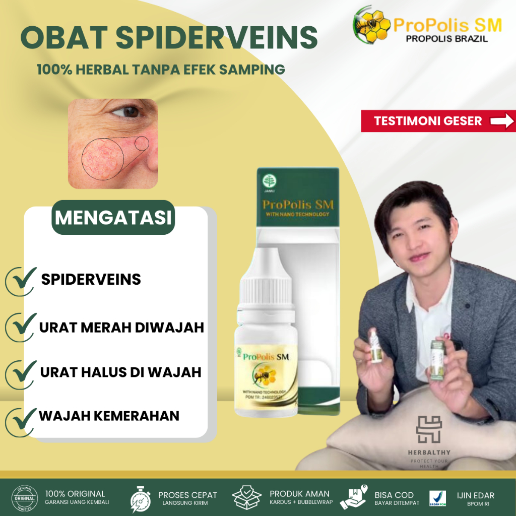Obat Herbal Anti Spider Vein, Obat Herbal Penghilang Urat Halus Di Wajah (spider vein), Obat Spider 