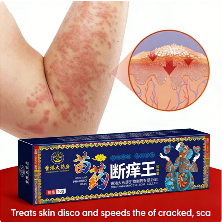 Salep kulit anti gatal Salep kulit antibakteri Salep kulit efektif Salep eksim anti gatal dari Cina 