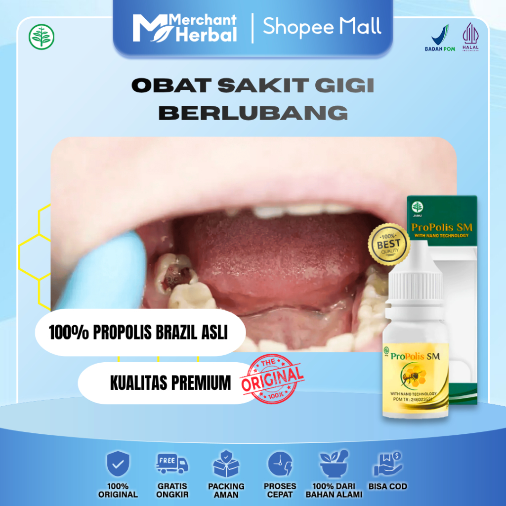 SAKIT GIGI BERLUBANG NYUT-NYUTAN – Propolis SM