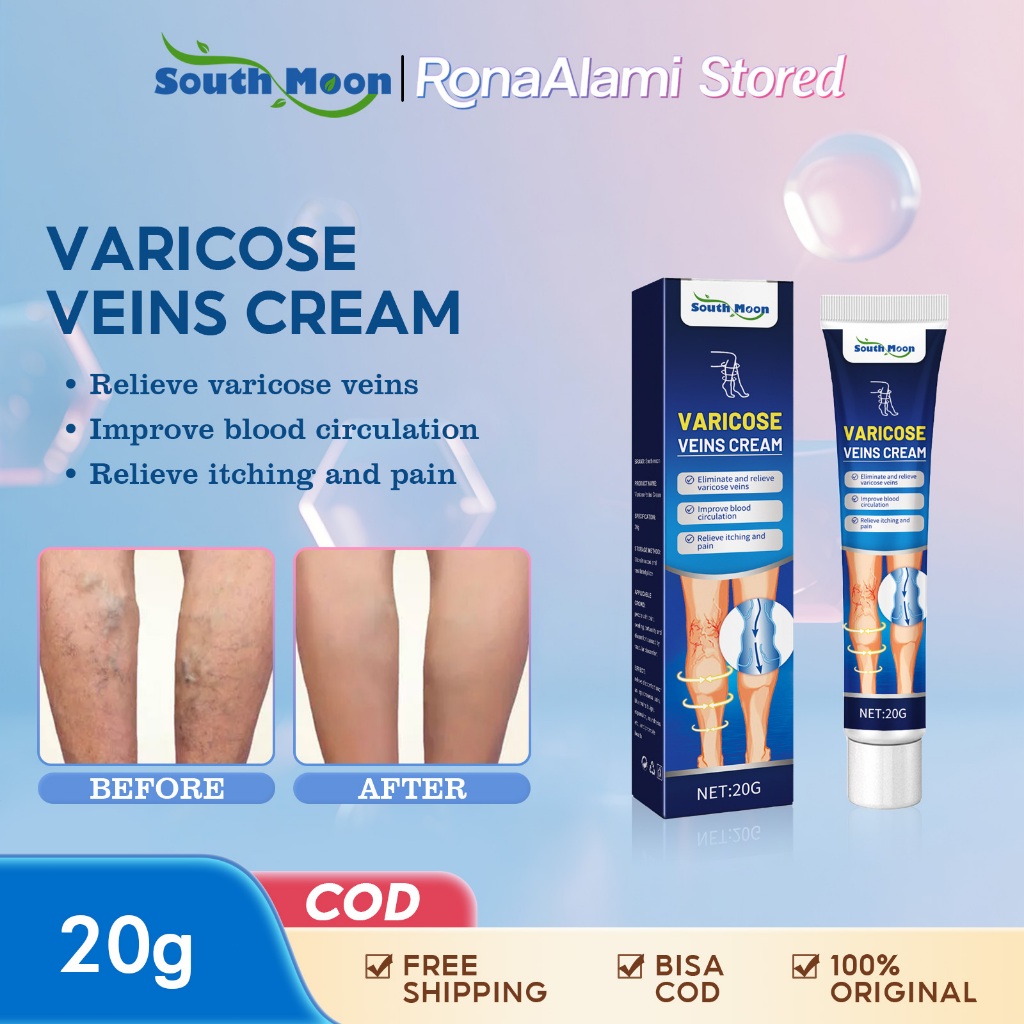 South Moon Varicose Veins Cream 20g - Obat Varises Paling Ampuh Obat Varises Di Kaki Dan Betis Palin