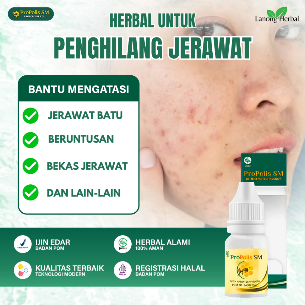 Propolis SM Asli Solusi Tuntas Jerawat Batu & Beruntusan - Obat Oles Jerawat Besar - Penawar Bekas J