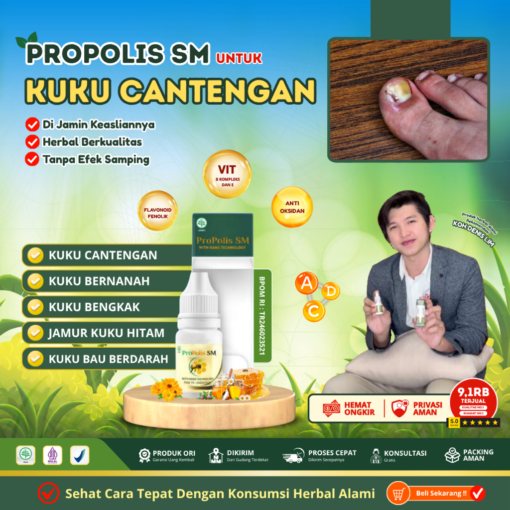 Obat Kuku Cantengan, Cantengan Jempol kaki, kuku Kaki Cantengan, Tetes Kuku Bengkak Bernanah Bau