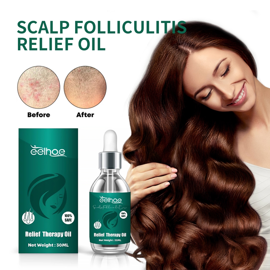 Eelhoe Relief Therapy Oil 30ml Serum Kulit Kepala Hair Oil Aromaterapi Message Oil Ketombe Obt Kepal