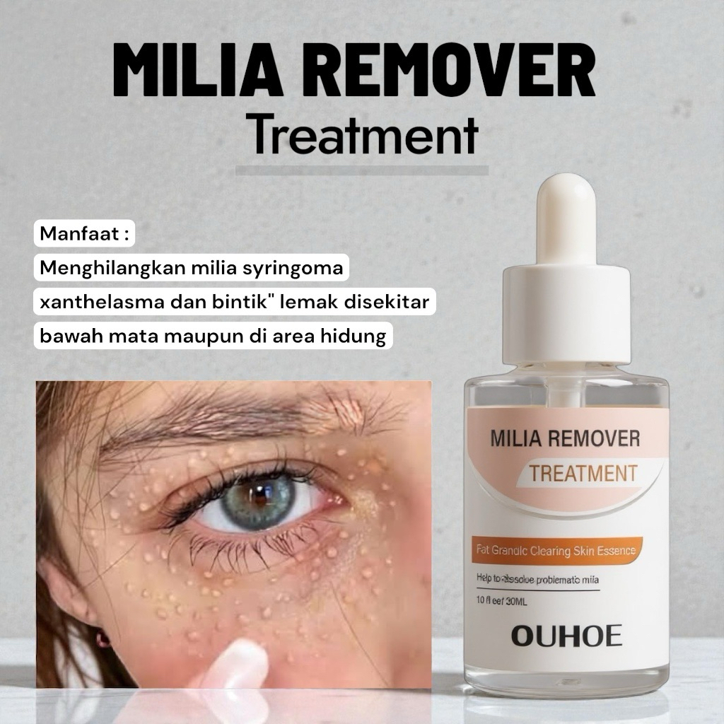MILIA REMOVER Serum Penghilang Perontok Milia Bintik Putih Mata Ouhoe Milia Remover Treatment serum