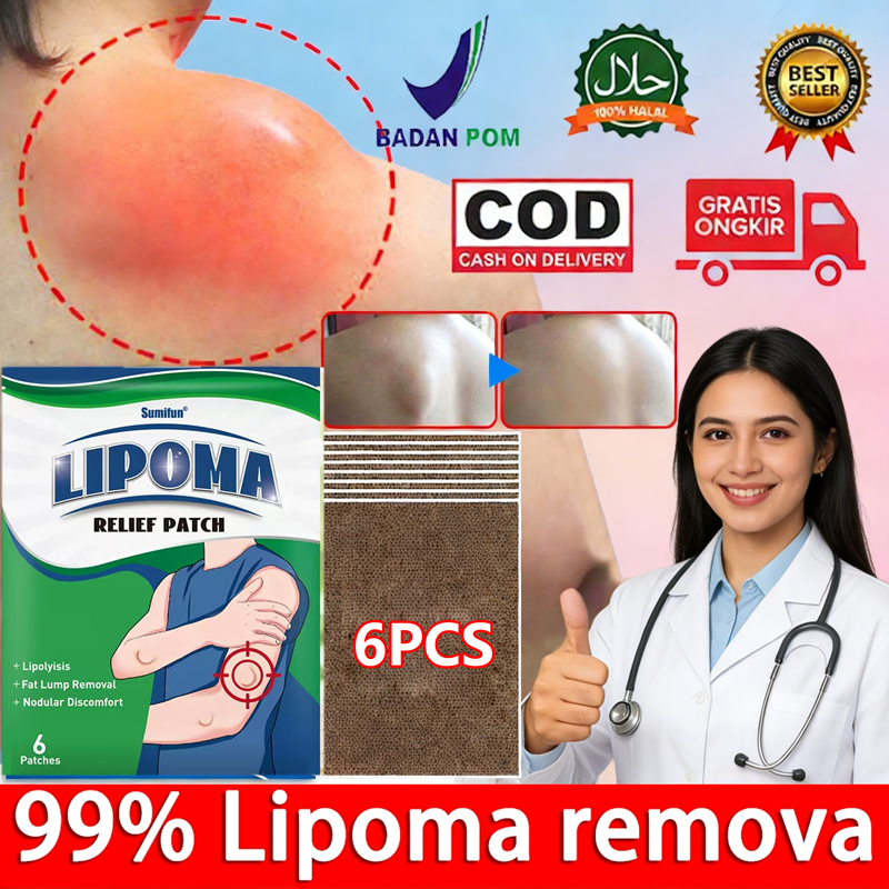 2 Pack 16 pcs Tablet Lipoma Plester Krim Lipoma Lipoma Cream 20g Krim Lipoma Obat Benjolan Lipoma Kr