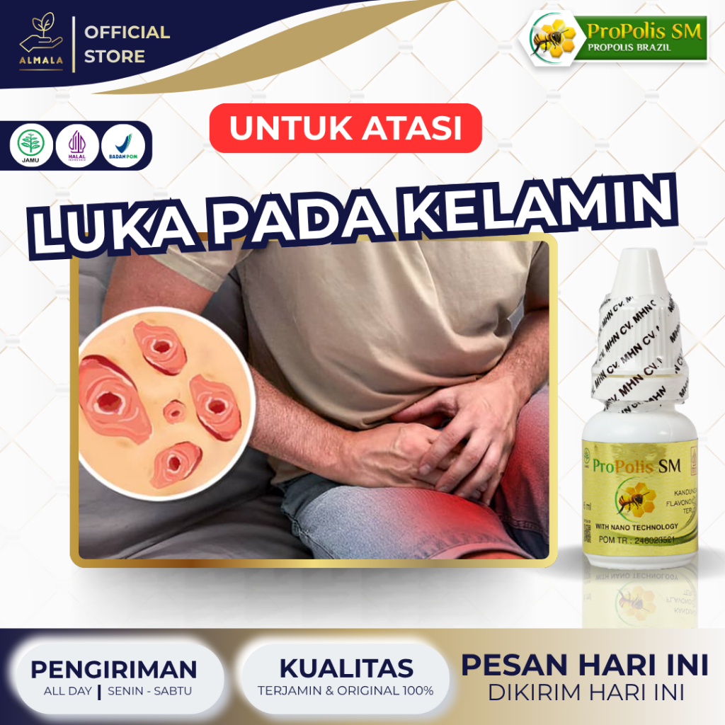 Obat Luka Pada Kelamin Pria, Obat Perih Luka Di Kelamin Pria, Obat Kelamin Lecet, Obat Penis Lecet, 