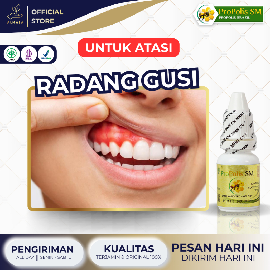 Obat Radang Gusi, Obat Gusi Turun, Obat Gusi Bengkak, Obat Gusi Berdarah, Obat Gusi Sakit, Obat Gusi