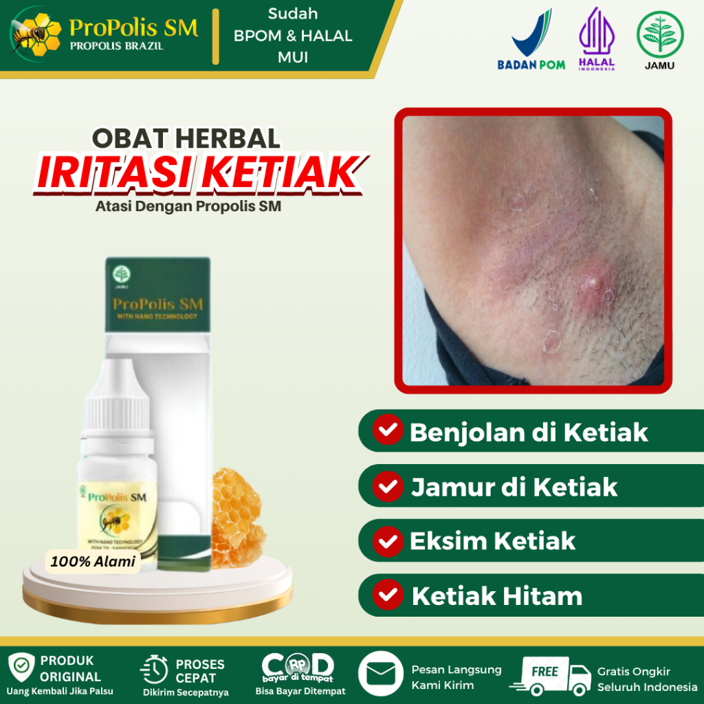 Obat Gatal Ketiak, Iritasi Ketiak, Benjolan di Ketiak, Jamur di Ketiak, Eksim Ketiak, Ketiak Hitam, 