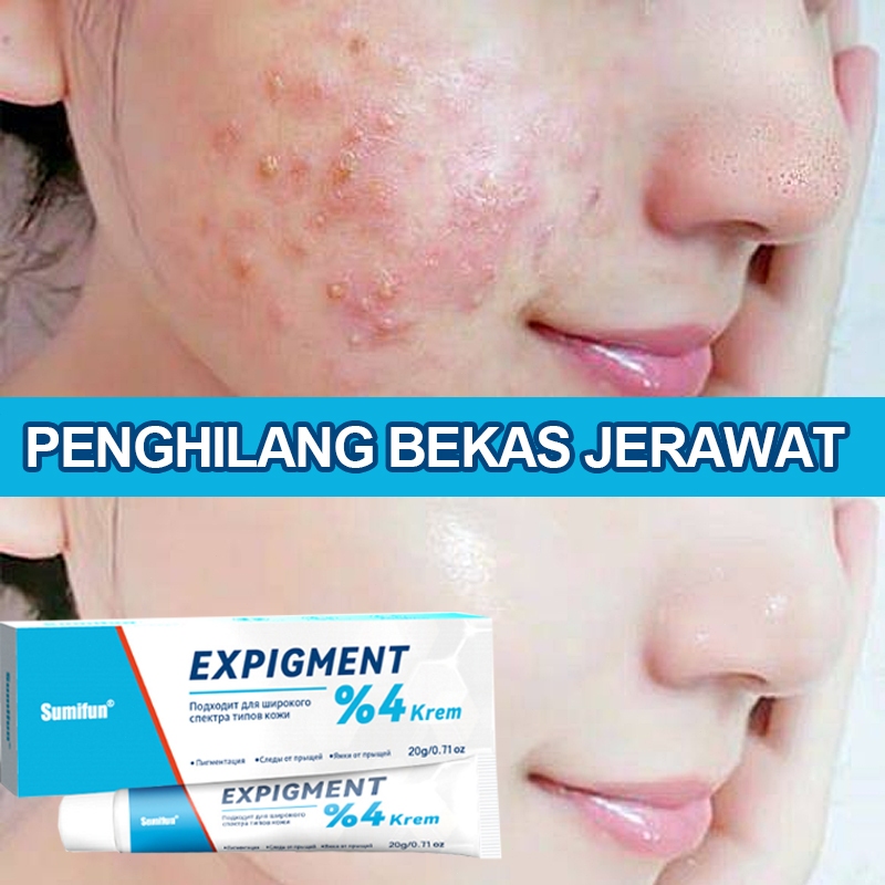 Penghilang Bekas Jerawat Salep Acnes Obat Jerawat Ampuh Acnes Totol Jerawat Serum Jerawat Dan Bekas 