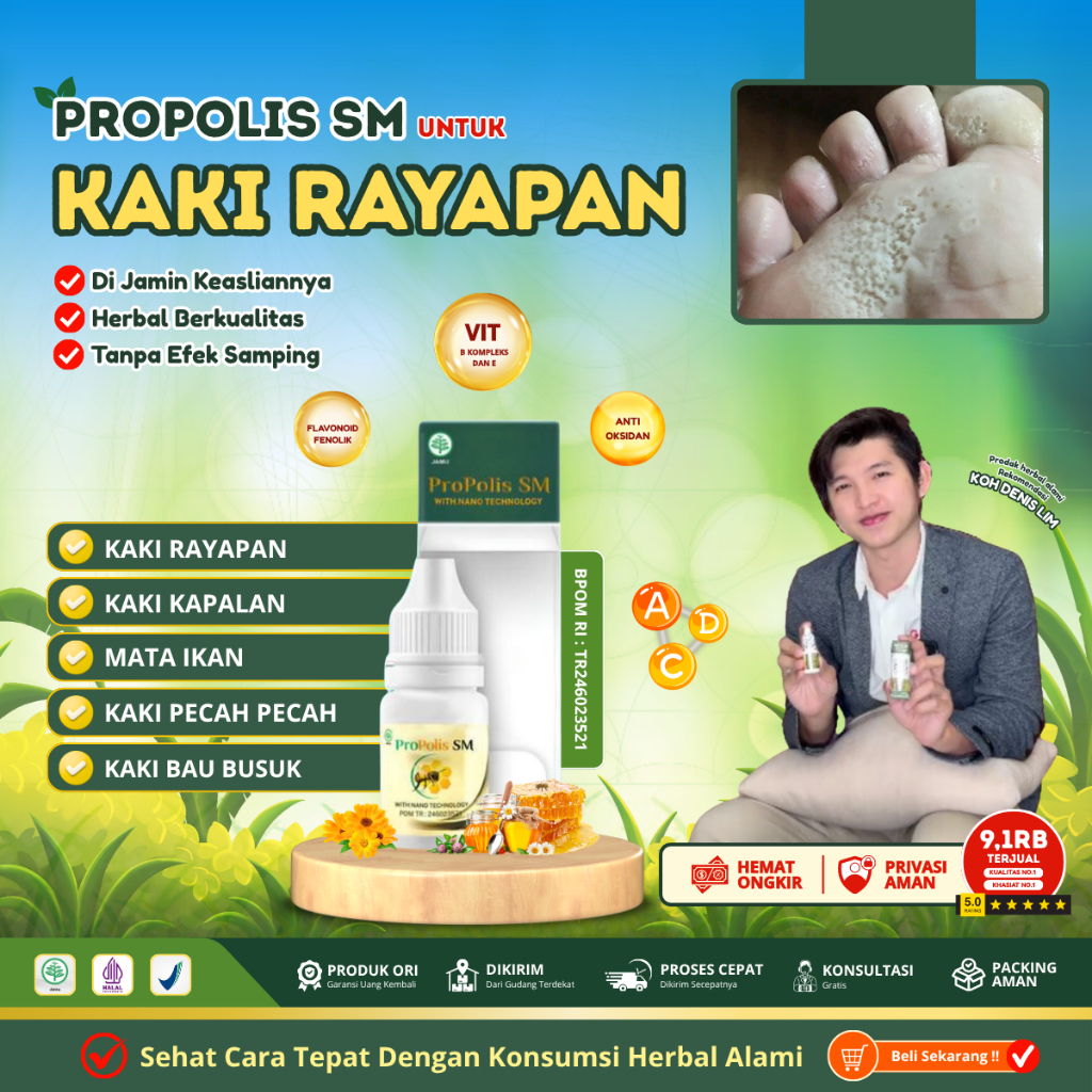 Obat Kaki Rayapan Berlubang Pitted Keratolysis, Obat Kaki Rayapan dan bau, Obat kaki rayapan Pecah, 