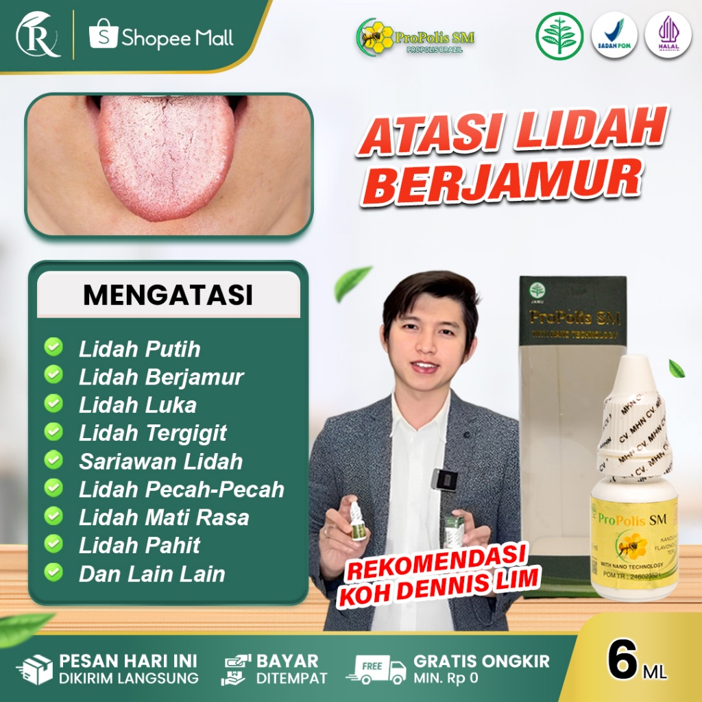 Obat Lidah Putih Lidah Berjamur Lidah Luka Tergigit Pecah Pecah dengan Propolis SM