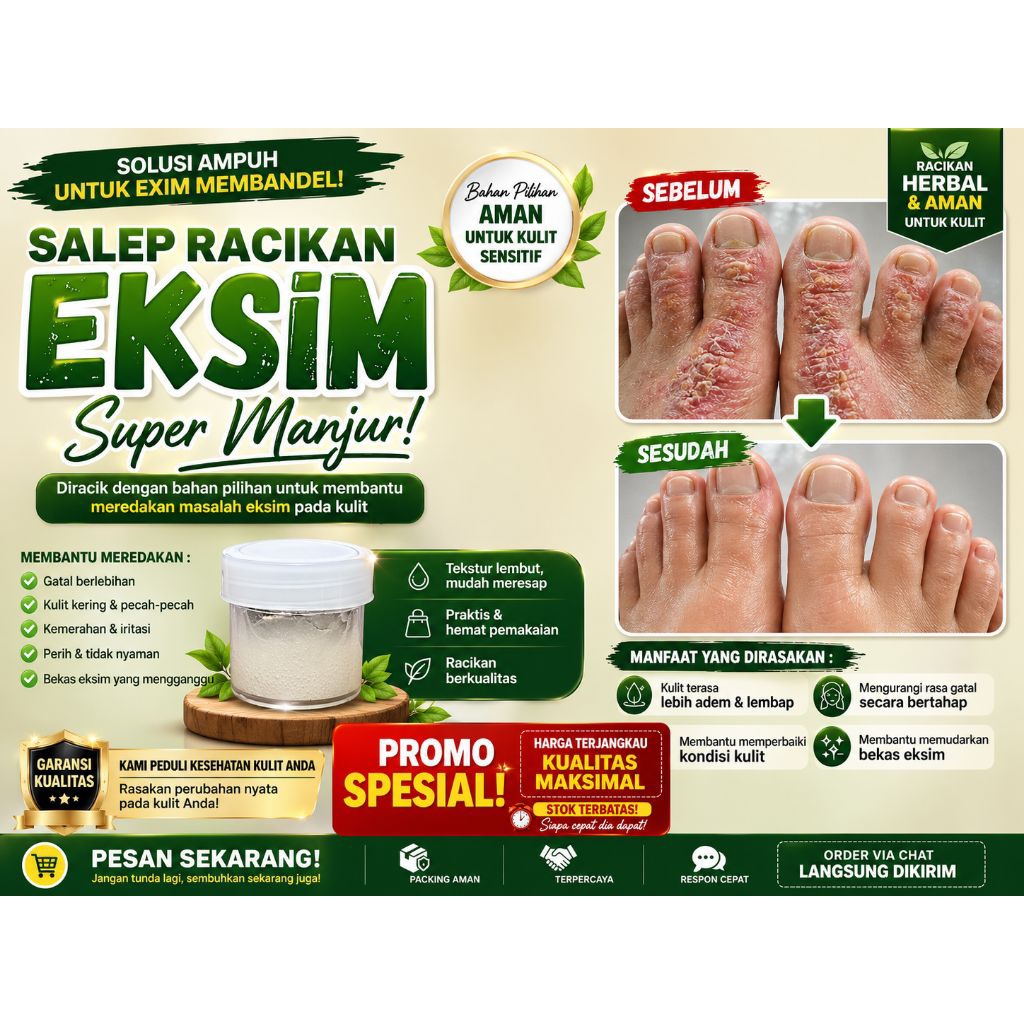 Eksim , Salep Racikan Super Manjur