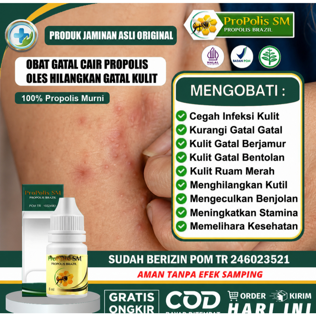 Obat Jamur Di Ketiak, Ketiak Lecet Dan Gatal, Ruam Ketiak, Salep Untuk Ketiak Lecet, Gatal Dan Perih