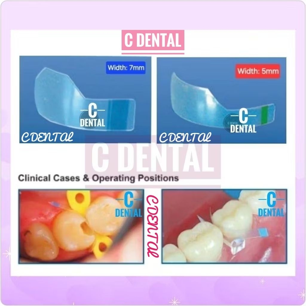 Dental Posterior Proximal Matrix Transparan Polyester Celluloid Strip