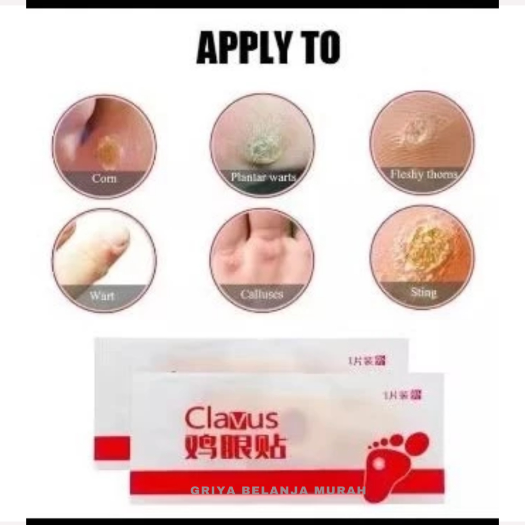 PLESTER MATA IKAN OBAT KUTIL KAPALAN ISI 6 PCS PLESTER OBAT KUTIL