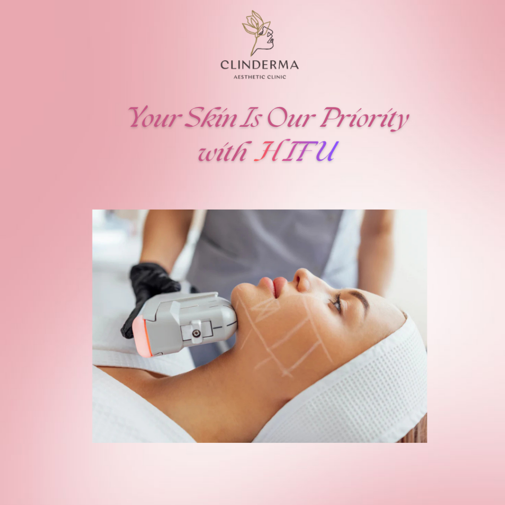 HIFU TREATMENT