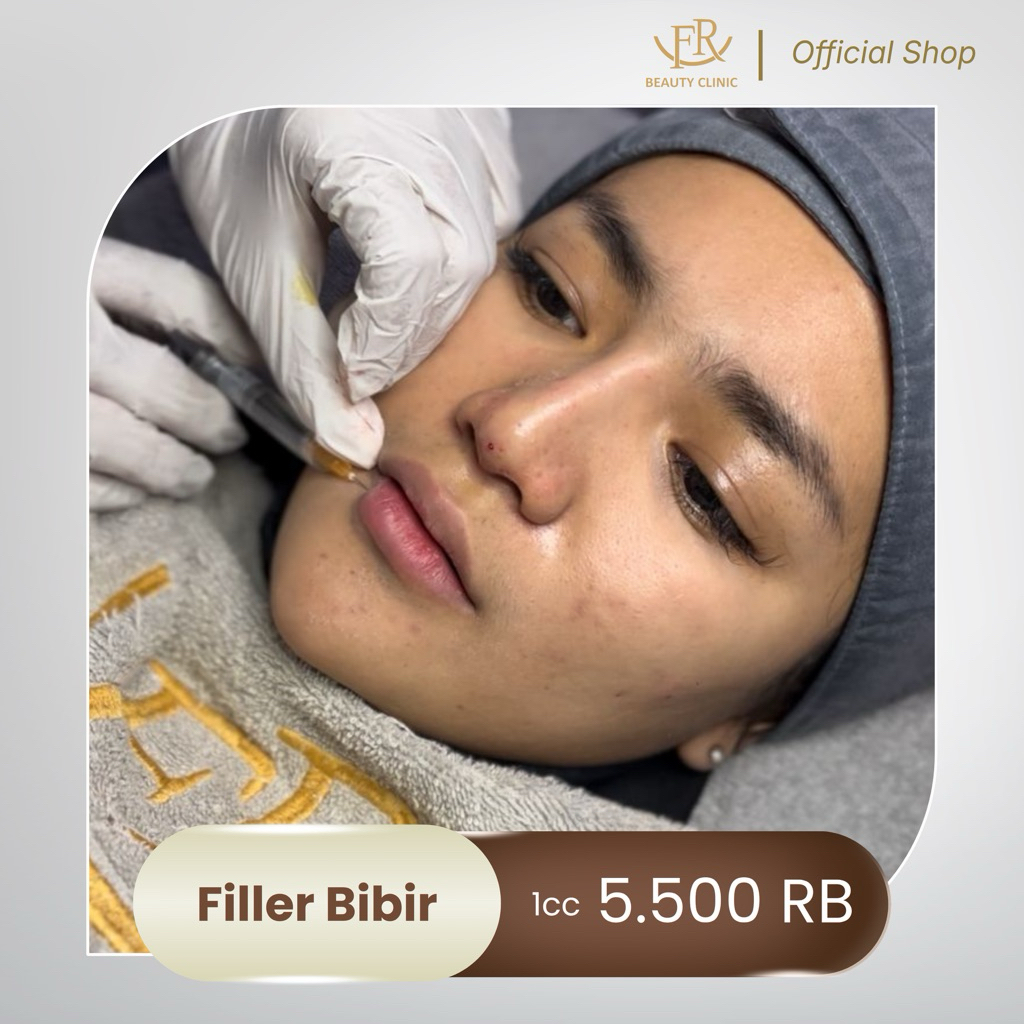 FR Beauty Clinic Filler Bibir