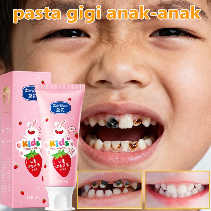 Odol Anak Probiotik Anti Gigi Berlubang Fluoride Rendah Aman untuk usia 1-12 tahun pasta gigi probio