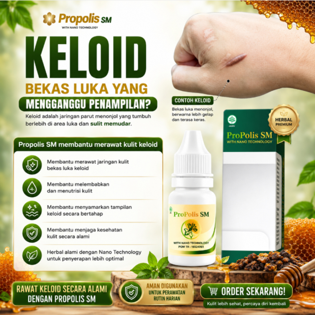 Obat Keloid Menahun Susah Hilang Daging Tumbuh Bekas Luka Operasi Bekas Luka Keloid Lama Keloid Beka
