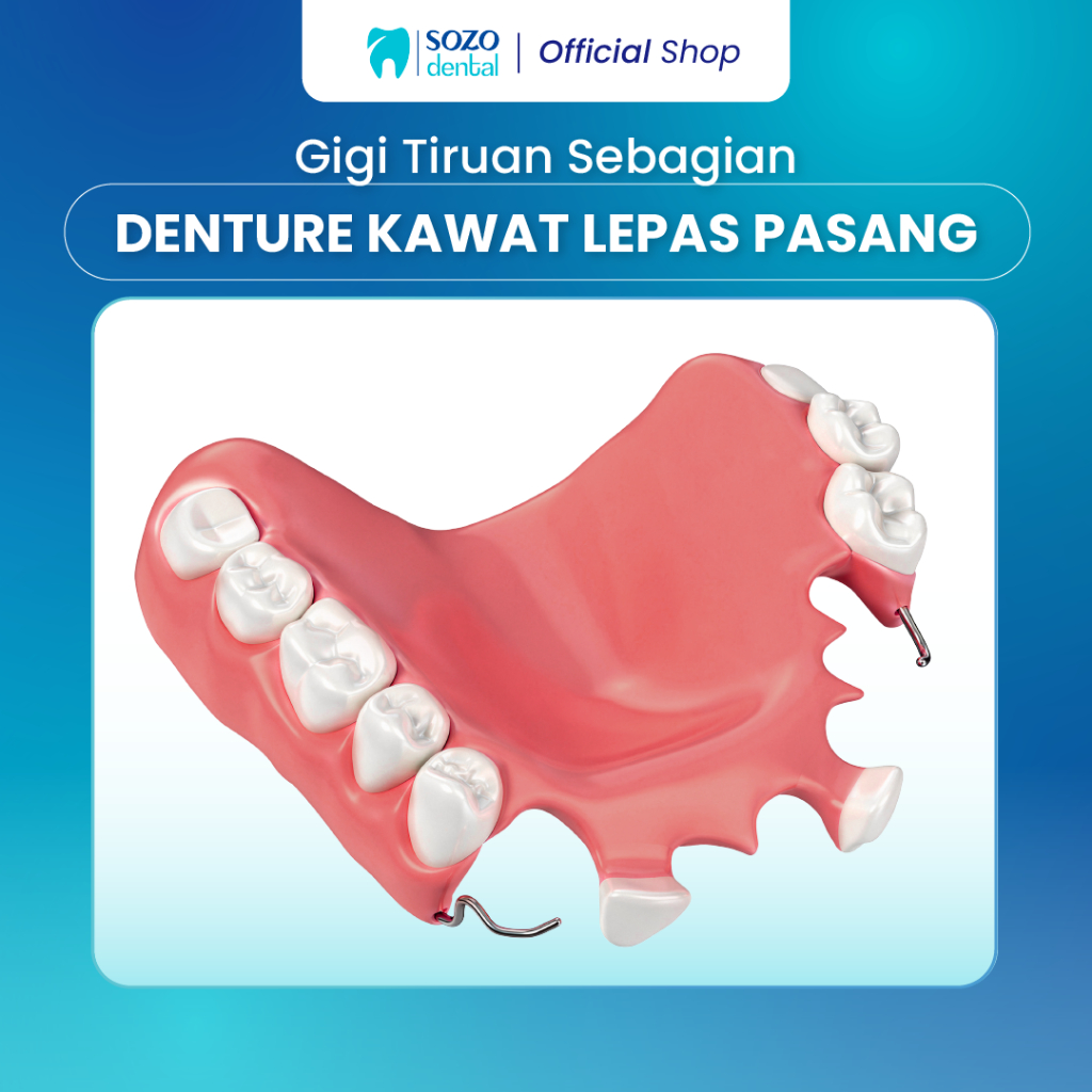 Sozo Dental - Gigi Palsu / Denture Kawat Sebagian Lepas Pasang