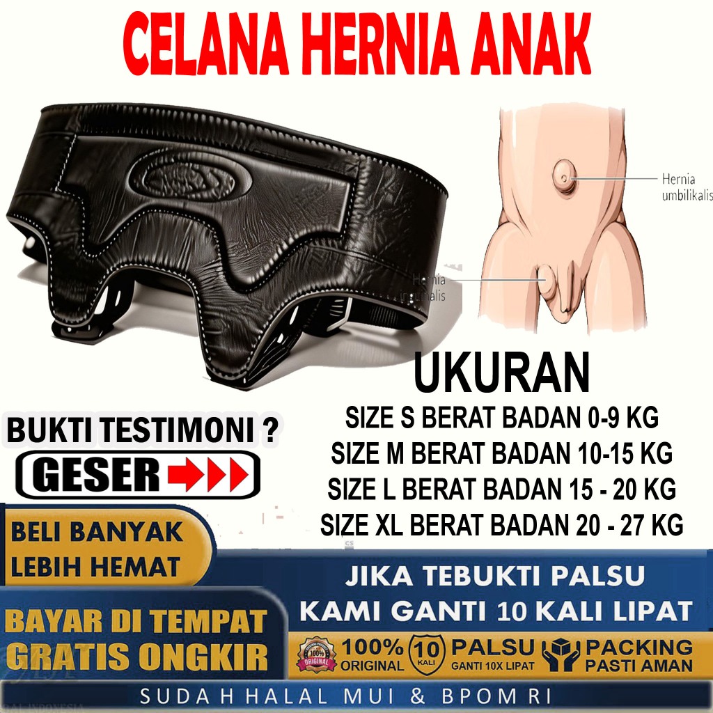 Celana Hernia Anak Paling Ampuh Bayi Balita Batita Atasi Turun Berok Sempak Selt Belt Korset Hernia