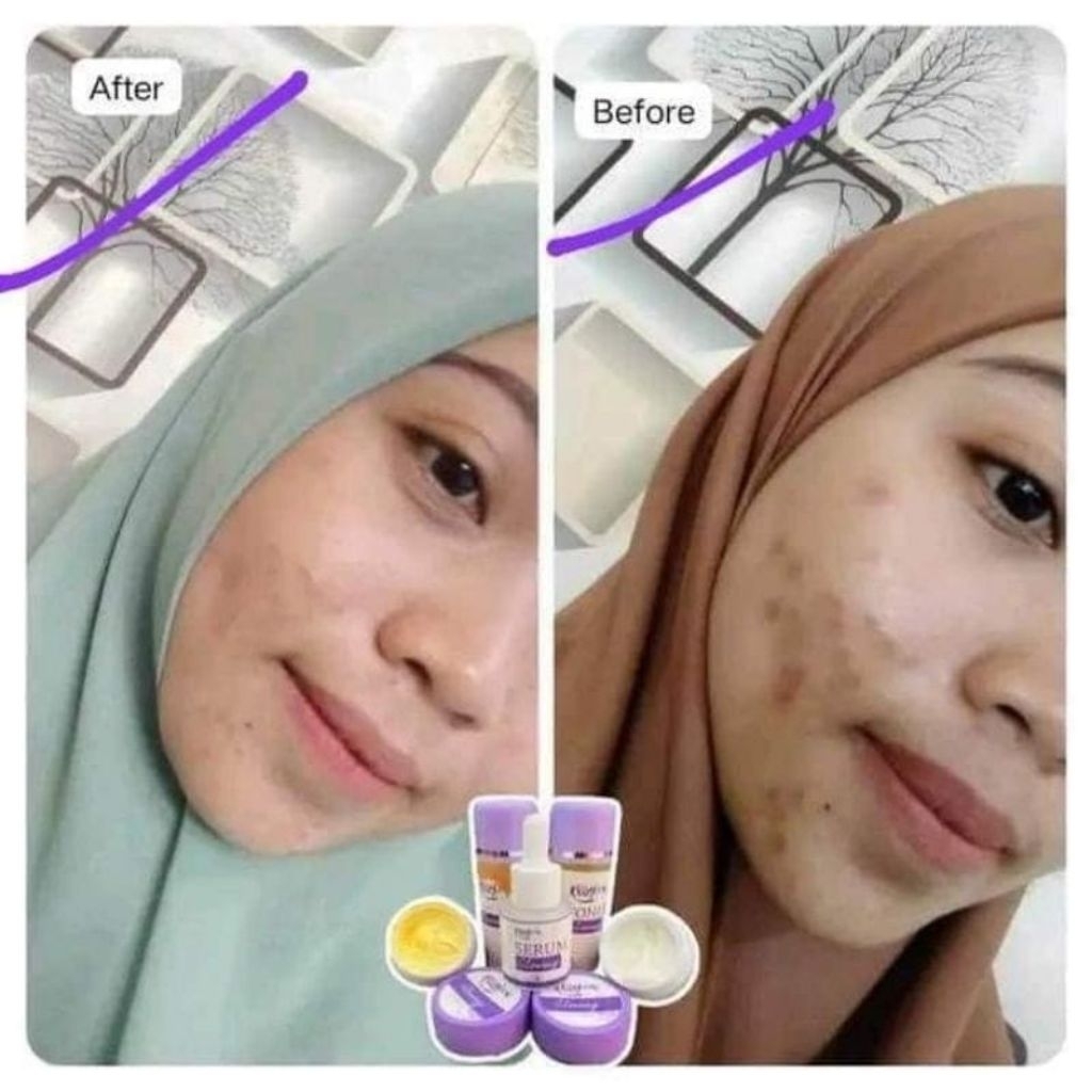 COD Paket Cream Kfssglow Skincare Original [5 Item] Lengkap Mengatasi semua jenis Kulit Aman ibu ham