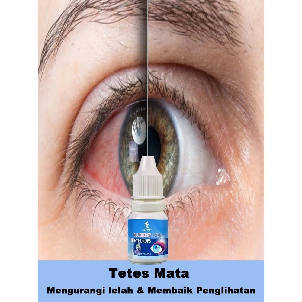 Tetes mata kering Obat tetes mata minus Tetes mata katarak Cocok utk sindrom mata kering, mata kabur