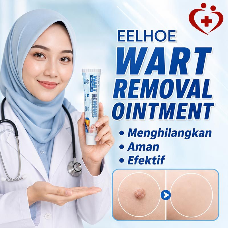 OOUWA Krim Penghilang Kutil Wajah / Penghilang Tahi Lalat dan Kutil / Obat Penghilang Kutil / Salep 