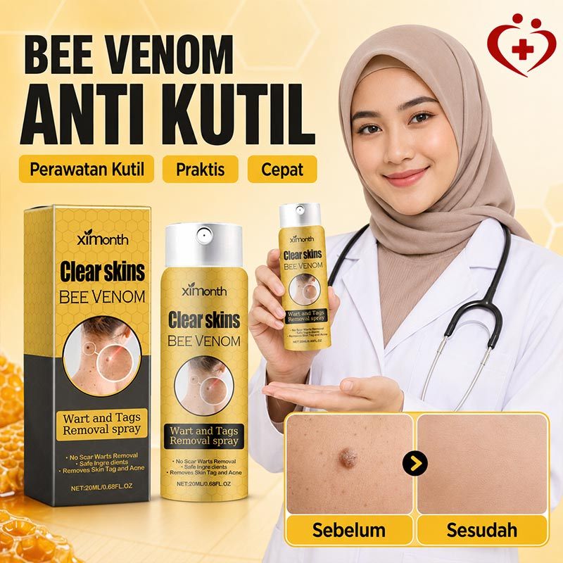 Semprotan Penghilang Kutil Racun Lebah OOUWA 20ml / Semprotan Penghilang Kutil Racun Lebah / Semprot
