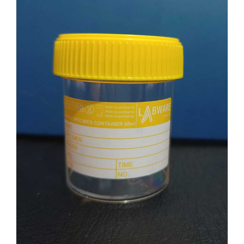 Pot Urine Steril Container Urine steril
